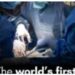 Suregons just completes the world’s first bladder transplant